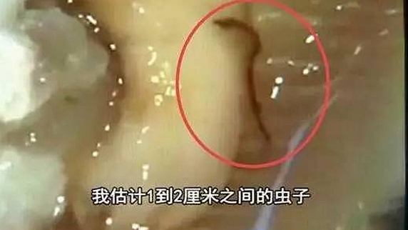 一只生蠔引起的冤案，觸動(dòng)了餐飲人的“麻木神經(jīng)”